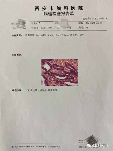 手术|结肠息肉怎么破？内镜帮您来搞定