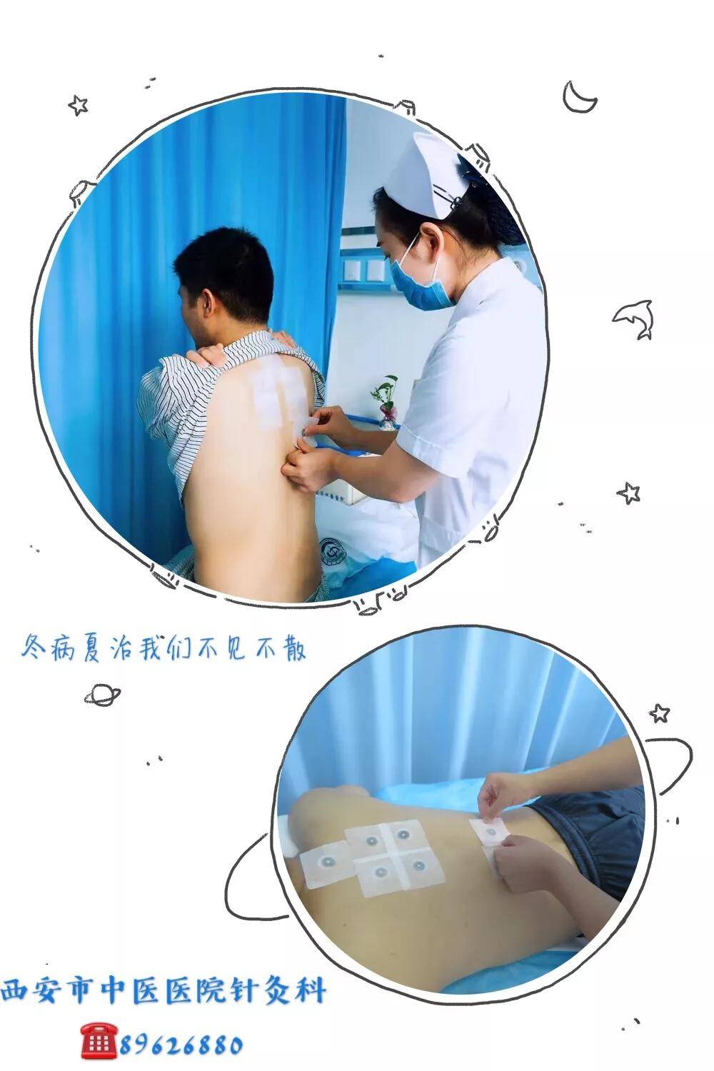 功能|针灸推拿康复科“冬病夏治”最佳搭档——三伏贴、火针、紫铜火罐中医特色组合