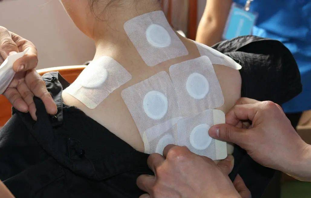 三伏贴时间:伏前: 2021年7月01日-----7月10日初伏: 2021年7月11号