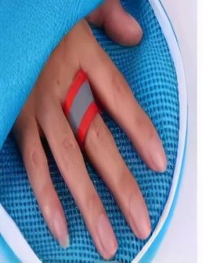 缺点|【护理科普】如何正确使用约束手套