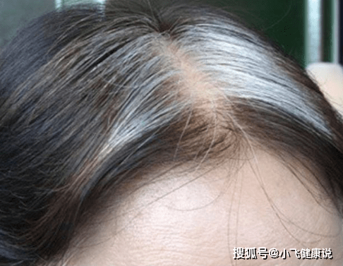 330c957b9a784c06950d998178906d58.png