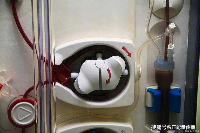 眼睛|尿毒症“现身”,身体知!身体出现这4“异常”,应高度警惕