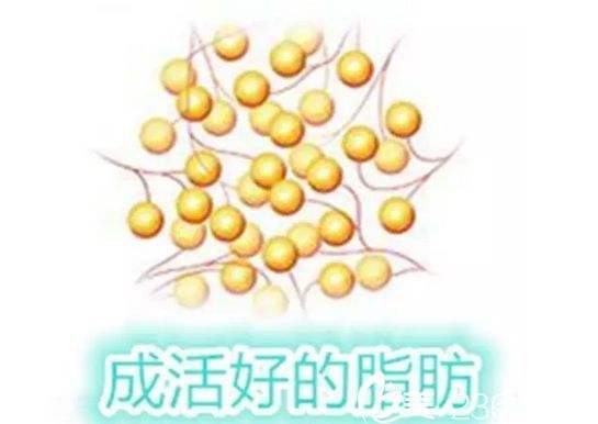 能量|面部脂肪填充维持多久？真人做过后的发言，这经必须得取！