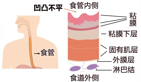 大白话说中医第一百五十期口腔食管通胃囊贲门把关做安防