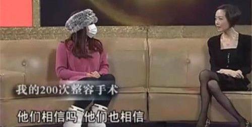 因为|红粉宝宝花400万,整容200多次,照片曝光后,网友:看久了会不适