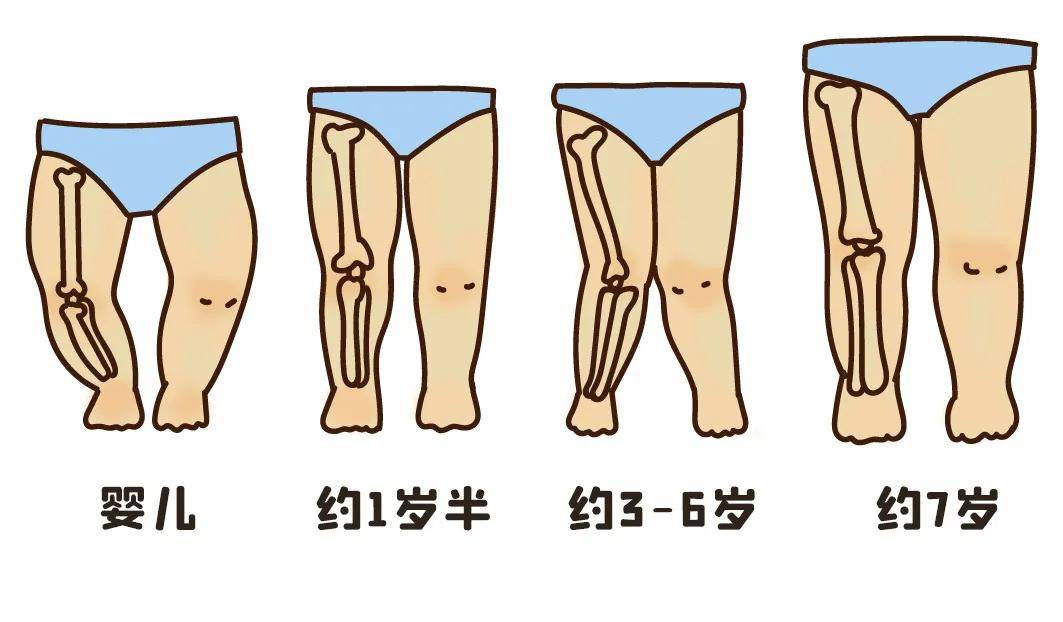 想要寶寶腿型發育好,應該注意些什麼?_家長