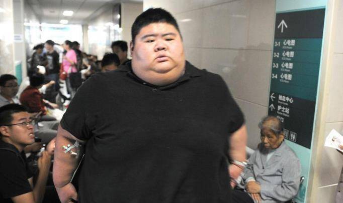 重668斤王浩楠 切二分之一胃 1年狂瘦400多斤 终抱得美人归 体重