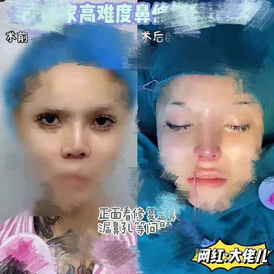 男儿身|高颜值的美女网红是男儿身？为整容花费几套房，真实性别难定论