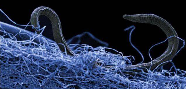 丝是多少微米的 f04da2414cfb431caef01d1c89871cc8.jpeg