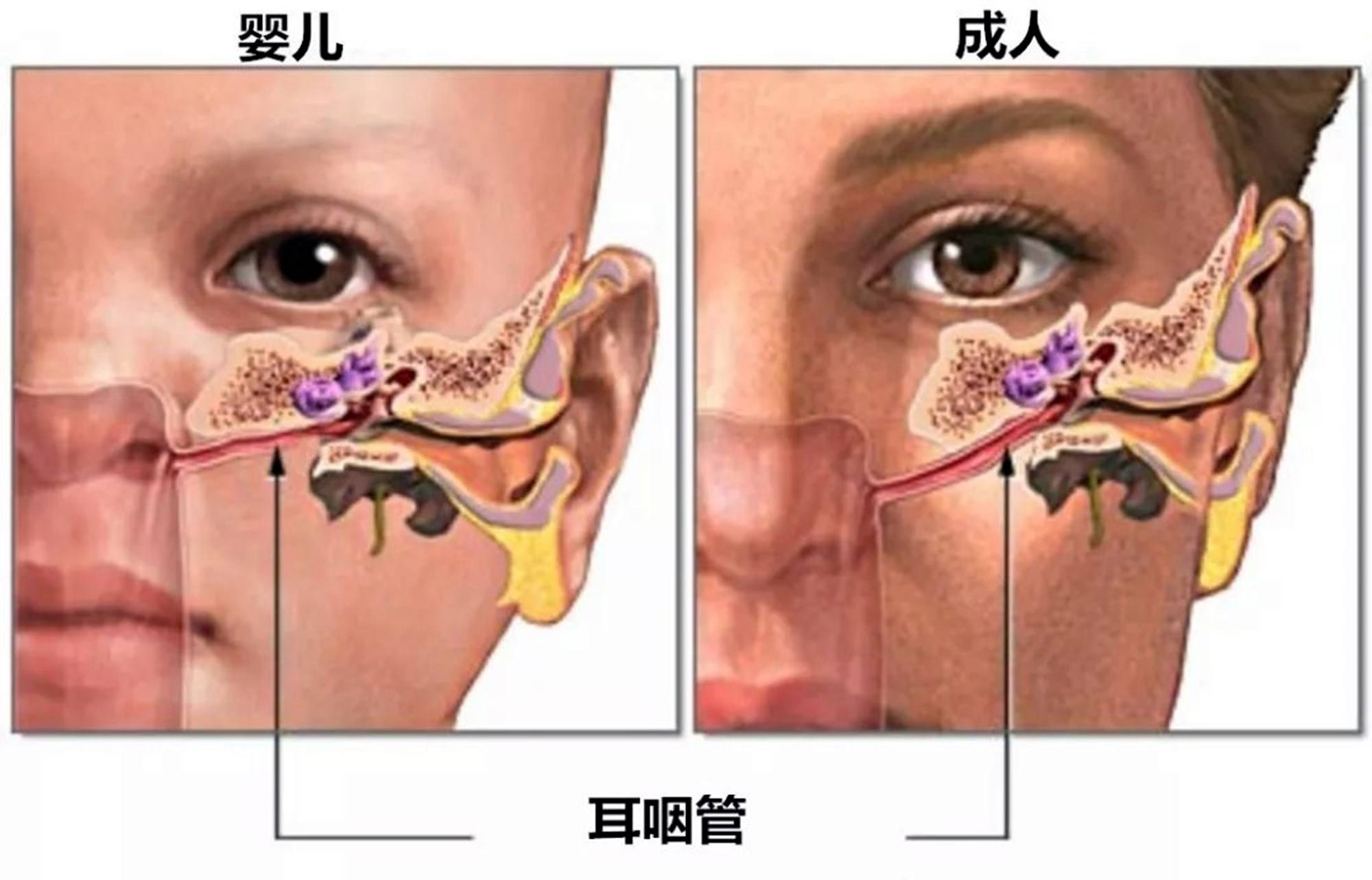 怎么样可以让自己耳膜穿孔 01c36a08bd40447b872ef0436ec8b413.jpeg