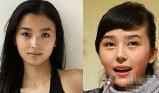 原创女星们整容前旧照 最后一个不敢认，太吓人