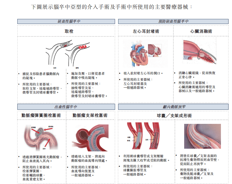 心瑋醫療上市在即，低估值神經介入頭部公司，值得看好嗎？ 科技 第3張