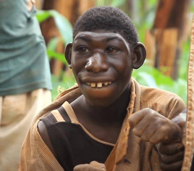 原创非洲一23岁男子平时爱吃香蕉长相像猴子常被人当动物欺负