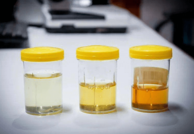 常怒|肝脏不好的人,早起会亮起这4个“红灯”!若你都没有,还算幸运