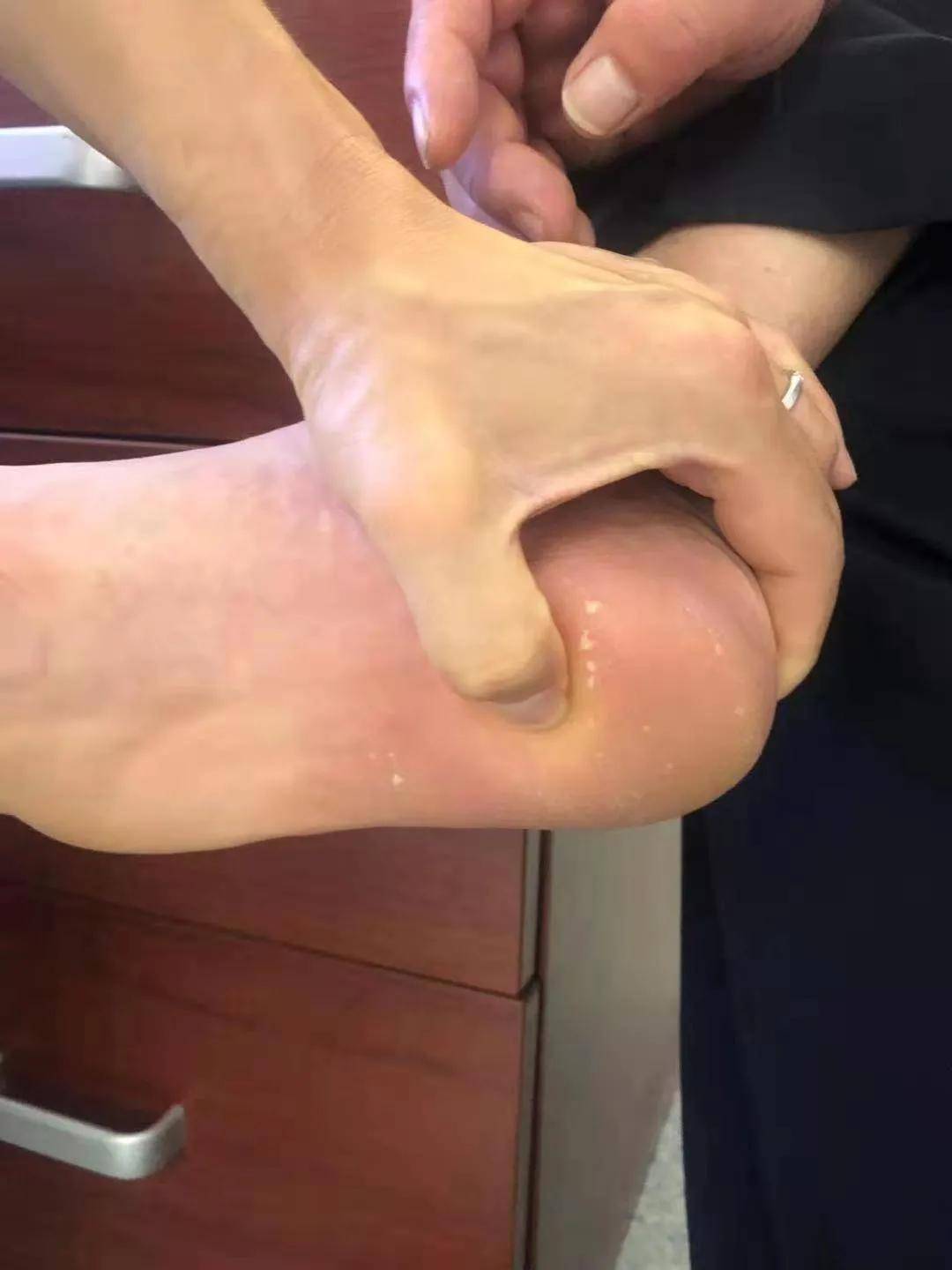 科普|全面科普跟痛症——怎么做到“不治而愈”？