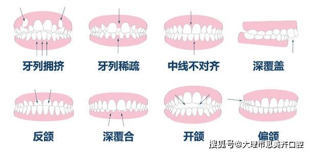 整齐的牙齿标准图片 17076bffc00547838c6bd9c60e02c53f.png