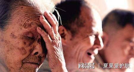 雀斑|色素斑点如何高效解决？圣秋波给你答案