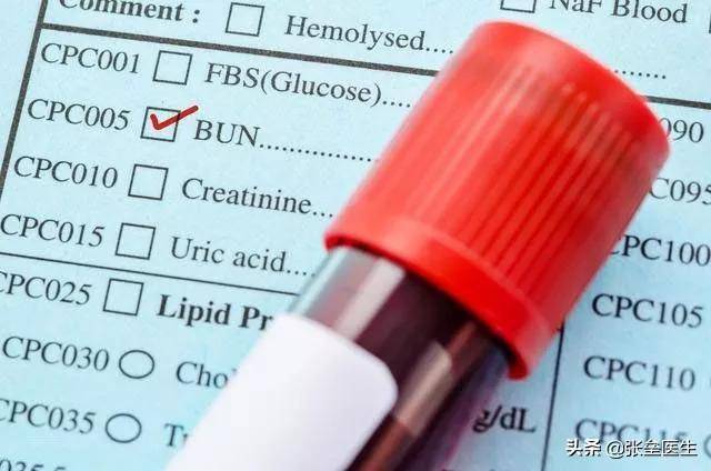 治疗|都说肌酐升高代表肾出问题?肾内科医师解释给您听,快快收藏起来