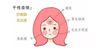 肤质|干皮如何在炎炎夏日保养护肤？