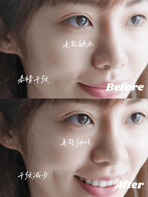 品牌|人生第一瓶贵妇面霜,无医美不垮脸!