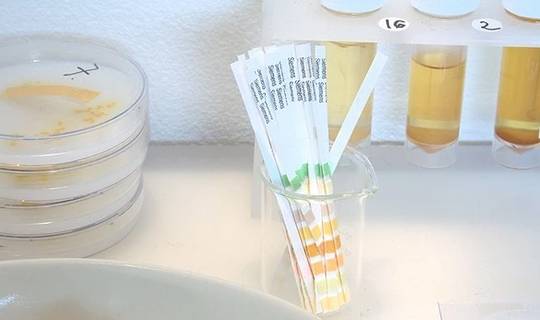 血液|如何正确认识蛋白尿？