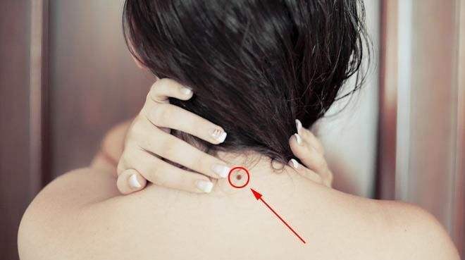 原创女人身上有这8处吉痣必定能荣华富贵