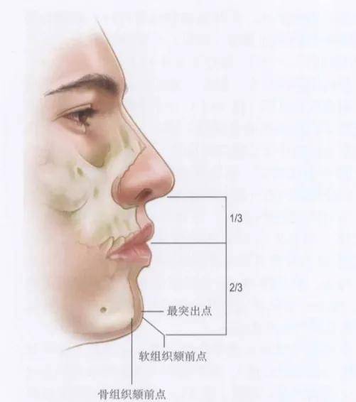 下巴|关晓彤的嘟囔下巴照这个古典路子走能封神？