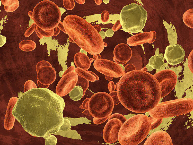 胆固醇高饮食清淡怎么吃