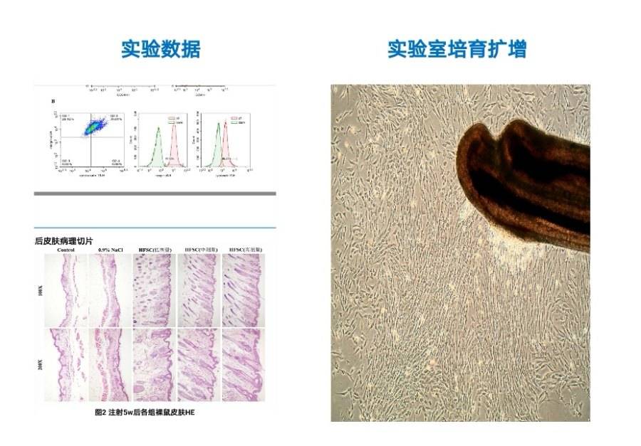 重大科学成就 -----首例毛囊干细胞再生技术在湖北研发成功