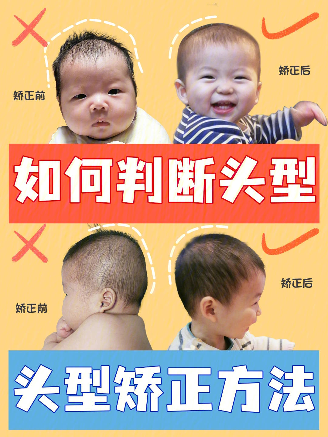 如何正确给宝宝做头型矫正 b8453398f2ac4316a2b33e59cb97391b.jpeg