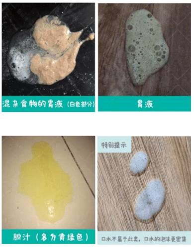 黑褐色胃液的图片图片