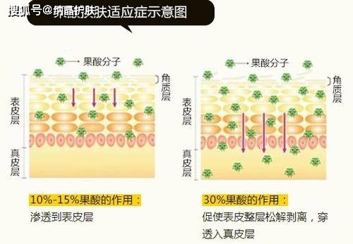 进行|夏日烂脸，满是痘印，新手小白在家可以刷酸焕肤吗？