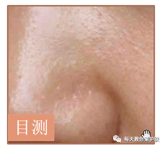 方法|油性肌肤怎么做才能比现在美十倍？