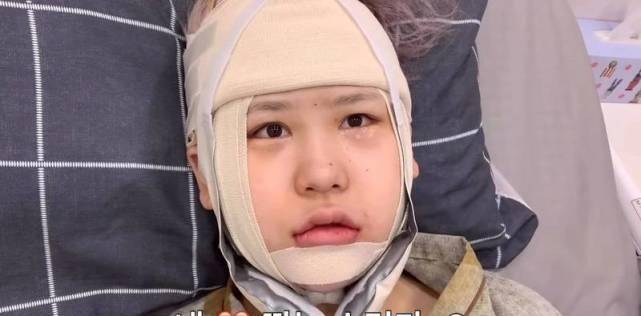 因为|20岁美女网红整容成瘾，隆胸后坦言：放了很多假体，痛到脸都肿了
