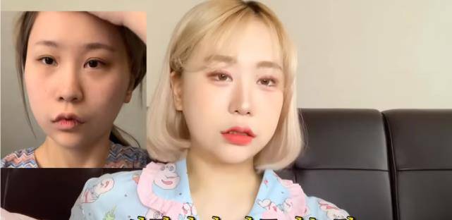 因为|20岁美女网红整容成瘾，隆胸后坦言：放了很多假体，痛到脸都肿了