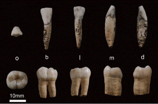 原创我们的牙齿是人类进化的漏洞