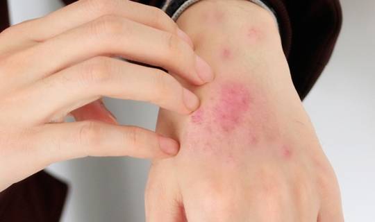 血糖|睡前有哪些表现,暗示血糖过高了?一个没有,恭喜血糖还算平稳