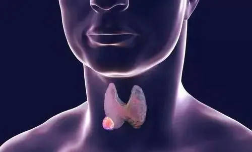云南中西医结合医院甲状腺专科:甲状腺结节多大算正常?