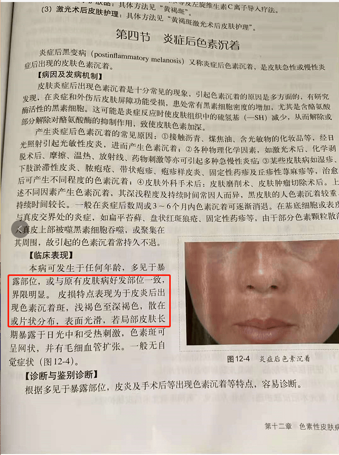 肠道|反复长痘,你护肤的手法正确吗?