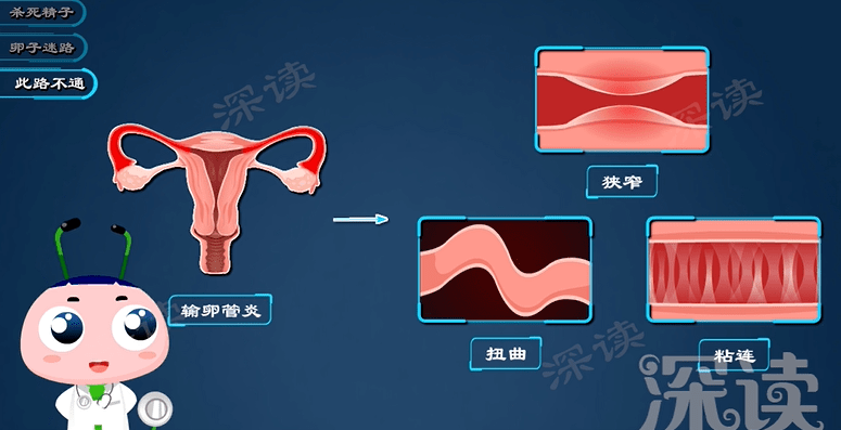 腹部隐痛白带异常还会不孕附件炎危害有多大硬核科普