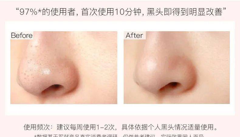 方法|速净黑头，收敛毛孔，还你光滑皮肤，这一个套盒就够了？！