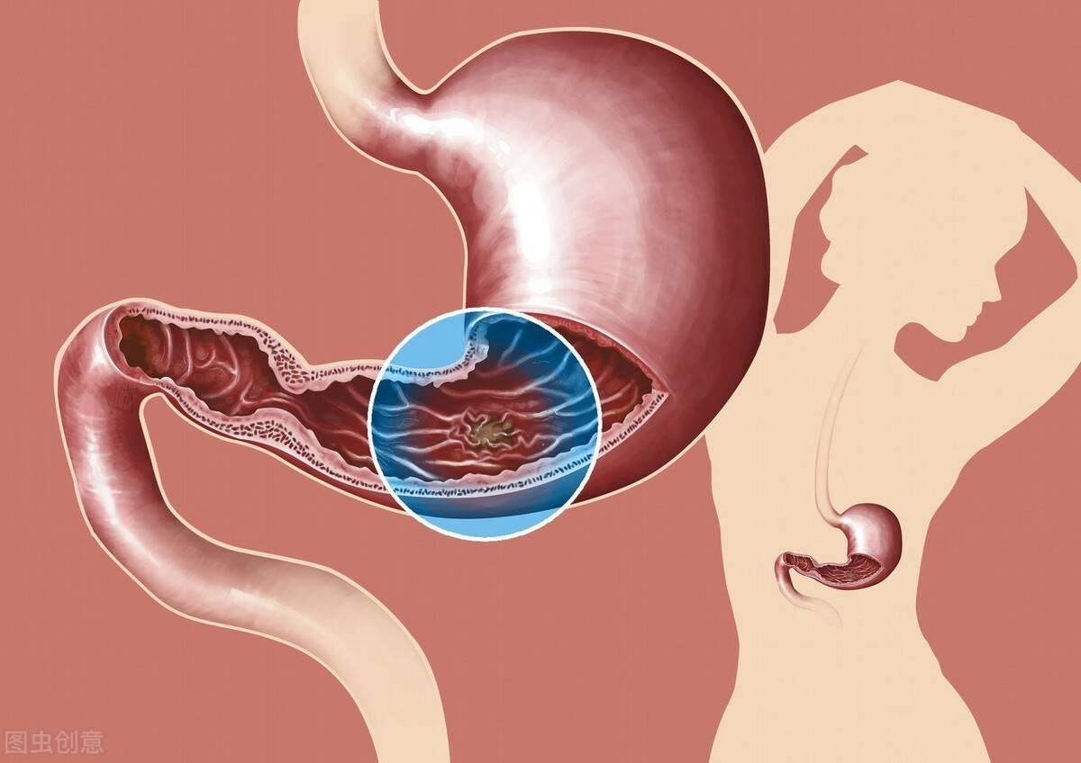 饮食|肠胃癌越来越多怎么办?早上两坚持,吃饭两不要,肠胃会更健康