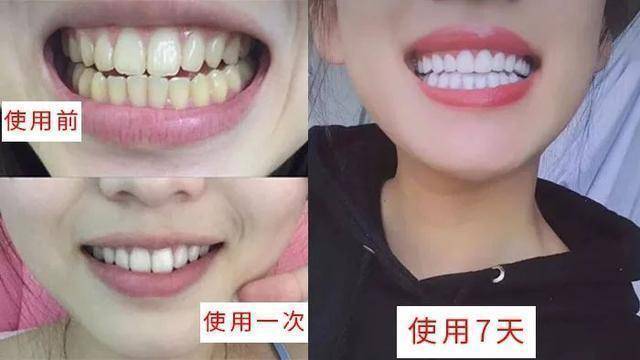 形象|屈臣氏有款被“埋没”的牙膏，高质价低，能去黄除垢、清新口气