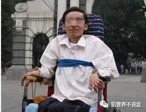 是一种|肌营养不良到底是一种什么样的疾病？