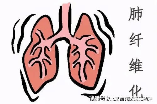 治疗|肺纤维化是怎么回事