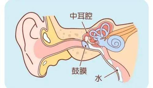民生|最容易被误诊的胆脂瘤，成都民生耳鼻喉医院：你一定要早发现