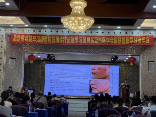 肌肤|东莞市医学会皮肤性病学分会年会圆满召开，康芙美获专家认可