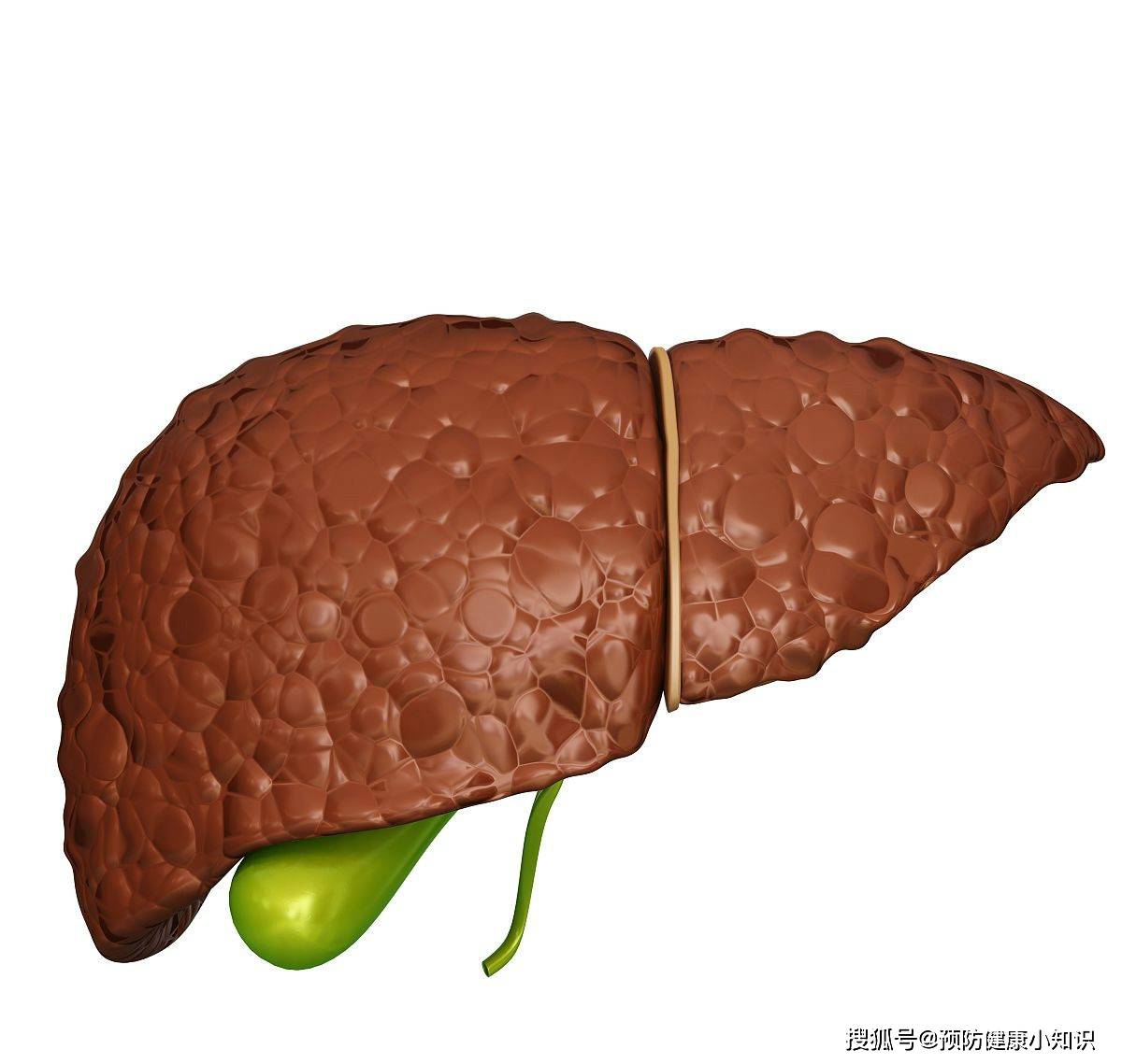 老唐|有没有肝癌，看一看眼睛就知道，长期喝酒的人不妨检查一下