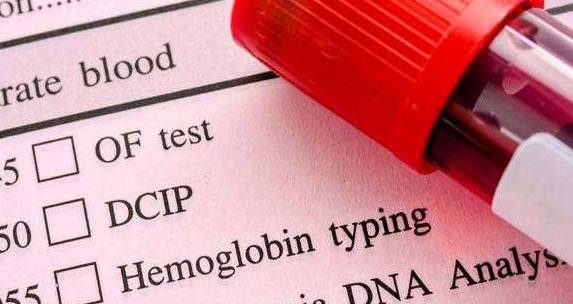 治疗|肾衰竭是尿毒症来临前的“危险信号”,这5个早期症状你必须知道