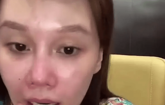 脸部|球球直播整容旧照，吐槽打针脸有一米长，亲妈都忍不住吐槽！